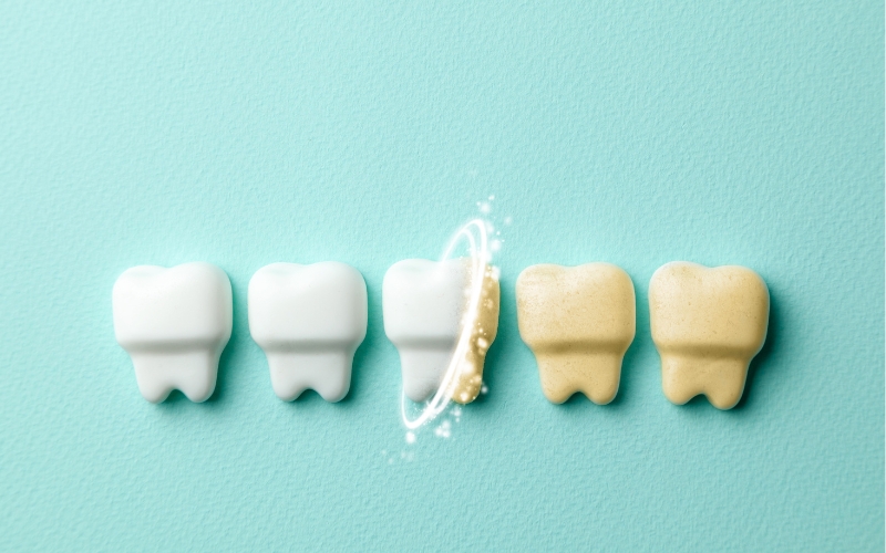 Tips To Make Teeth Whitening Last Longer