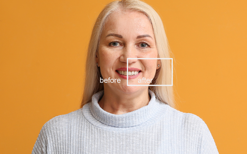 How Smile Makeovers Can Help You Avoid A Frightful Grin This Halloween?