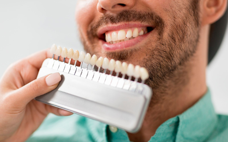Smile Makeover For Men: Breaking The Stereotype Of Cosmetic Dentistry