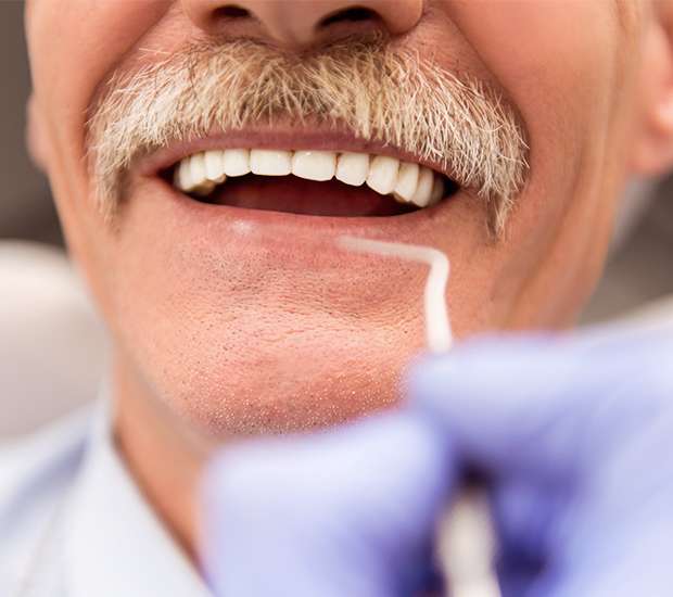 Boca Raton Adjusting to New Dentures