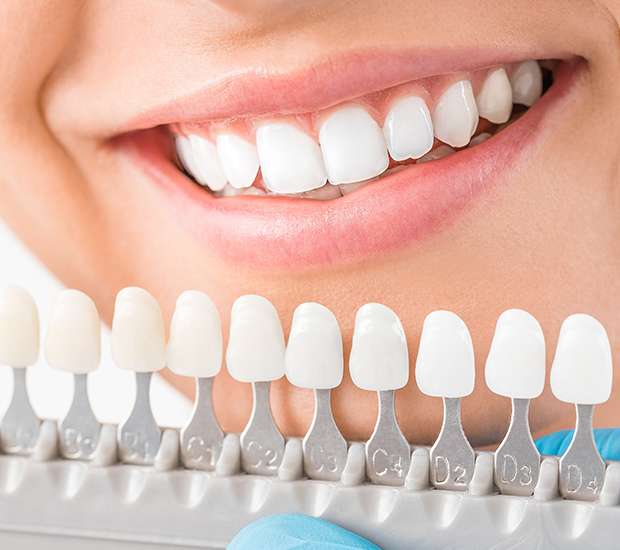 Boca Raton Cosmetic Dentist