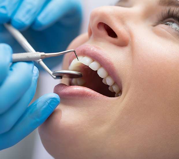 Boca Raton Dental Bonding