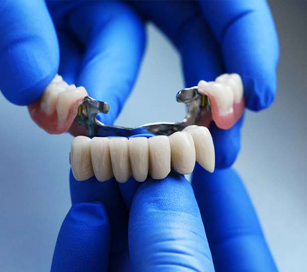 Boca Raton Dental Bridges