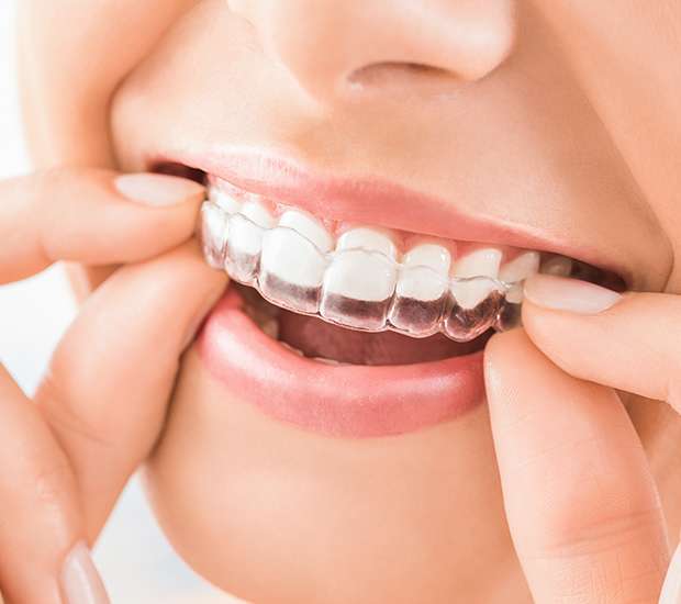 Boca Raton Does Invisalign Really Work