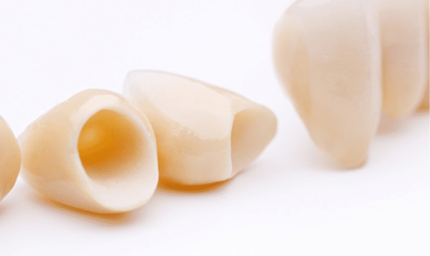 Essential Dental Crown Aftercare Tips For A Healthy Smile