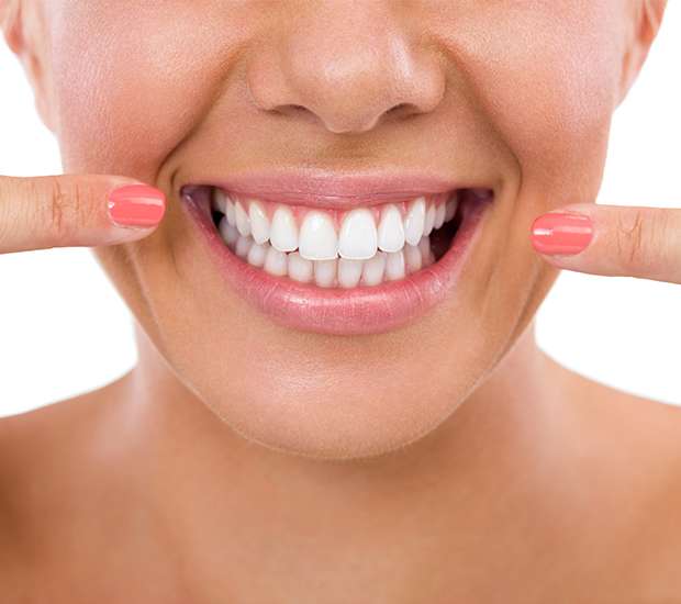Boca Raton What Is Gum Contouring & Reshaping