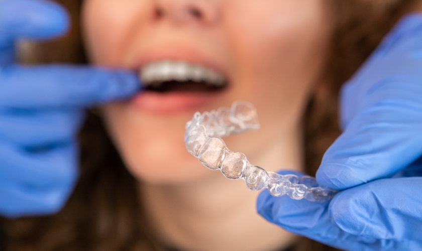 Can You Get Invisalign With Wisdom Teeth?