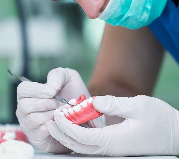 Boca Raton Partial Denture for One Missing Tooth