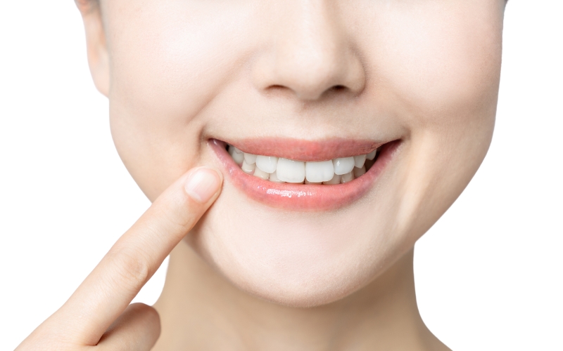 What Is A Smile Makeover And How Much Does It Cost In Florida?
