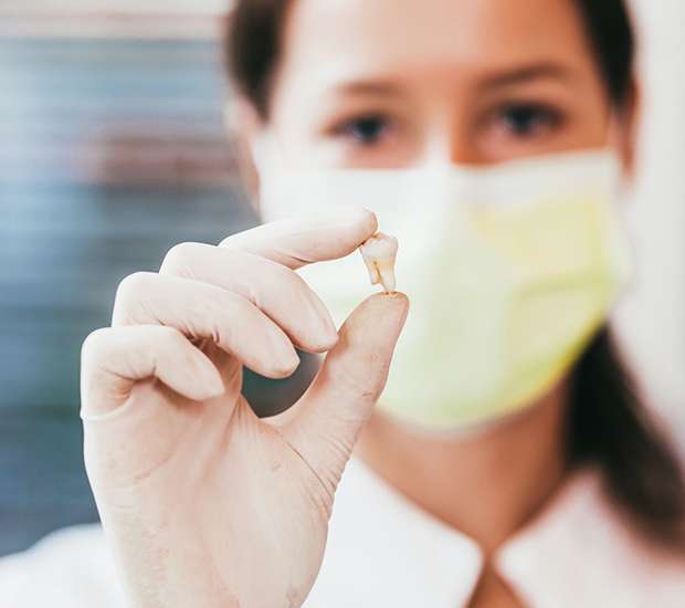 Boca Raton Tooth Extraction