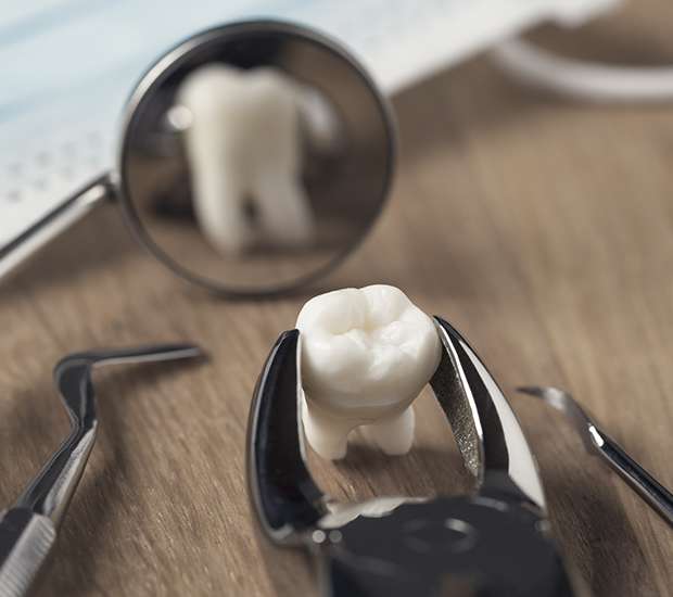 Boca Raton When Is a Tooth Extraction Necessary